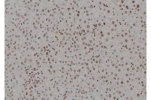 ABIN6277358 at 1/100 staining Mouse liver tissue by IHC-P. (DDB1 抗体  (C-Term))
