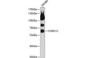 Western blot analysis of extracts of SW480 cells, using CORO1C antibody (ABIN1679327, ABIN3019058, ABIN3019059 and ABIN6220690) at 1:1000 dilution.