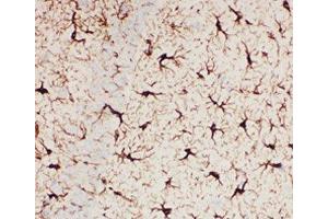Immunohistochemistry (IHC) image for anti-Glial Fibrillary Acidic Protein (GFAP) (AA 93-432) antibody (ABIN3031046)