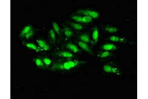 Immunofluorescent analysis of Hela cells using ABIN7150624 at dilution of 1:100 and Alexa Fluor 488-congugated AffiniPure Goat Anti-Rabbit IgG(H+L) (Mre11 抗体  (AA 1-205))