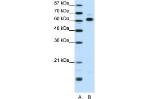 WB Suggested Anti-TRIP4 Antibody Titration:  1. (TRIP4 抗体  (Middle Region))