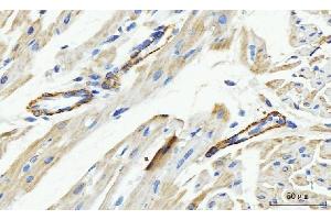 IHC analysis of MT-ND5 using anti-MT-ND5 antibody (ABIN7600145).