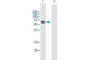 Western Blot analysis of PKNOX1 expression in transfected 293T cell line by PKNOX1 MaxPab polyclonal antibody. (PKNOX1 抗体  (AA 1-436))