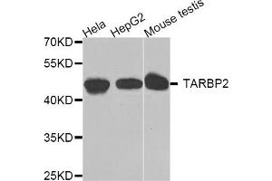 Western blot analysis of extracts of various cell lines, using TARBP2 antibody. (TRBP 抗体)