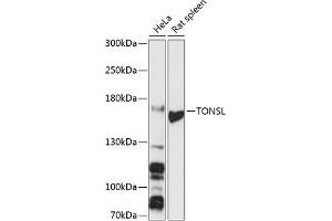 Western blot analysis of extracts of various cell lines, using TONSL antibody (ABIN6132818, ABIN6149388, ABIN6149389 and ABIN6216872) at 1:3000 dilution. (NFKBIL2 抗体  (AA 160-390))