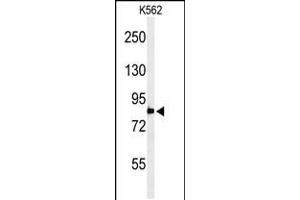 Western blot analysis of PLA2G4B Antibody in K562 cell line lysates (35ug/lane) (PLA2G4B 抗体  (AA 396-424))