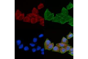 ABIN6258910 and ABIN6275186 staining Hela cells(30 min of UV treatment) by IF/ICC. (HLA-DOA 抗体  (N-Term))