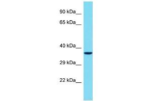 Host: Rabbit Target Name: TBATA Sample Type: Jurkat Whole Cell lysates Antibody Dilution: 1. (C10orf27 抗体  (C-Term))