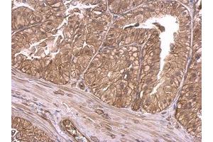 IHC-P Image Insulin Receptor antibody detects Insulin Receptor protein at membrane on mouse prostate by immunohistochemical analysis. (Insulin Receptor 抗体  (C-Term))
