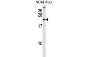 Western Blotting (WB) image for anti-Ribosomal Protein S16 (RPS16) antibody (ABIN2998333) (RPS16 抗体)