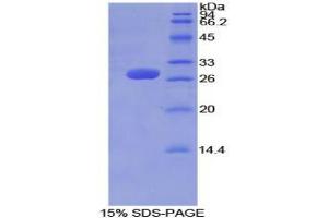 SDS-PAGE analysis of Mouse Tubulin delta Protein. (TUBD1 蛋白)