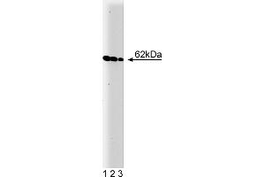 Western Blotting (WB) image for anti-V-Yes-1 Yamaguchi Sarcoma Viral Oncogene Homolog 1 (YES1) (AA 10-193) antibody (ABIN967927) (YES1 抗体  (AA 10-193))