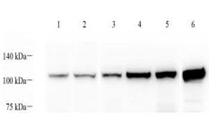 Western blot analysis of alpha Actinin (ABIN7073023) at dilution of 1: 1000,Lane 1: MCF7 cell lysate,Lane 2: Hela cell lysate,Lane 3: Mouse spleen tissue lysate,Lane 4: Mouse skeletal muscle tissue lysate,Lane 5: Mouse heart tissue lysate,Lane 6: Rat skeletal muscle tissue lysate (alpha Actinin 抗体)