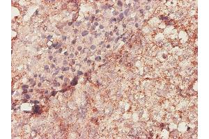 Immunostaining (ISt) image for anti-Biglycan (BGN) (AA 1-368) antibody (ABIN560056)