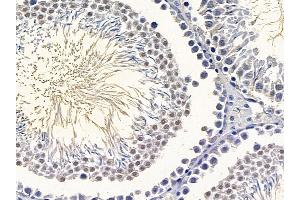 ABIN6265350 and ABIN6266871 at 1/100 staining rat testis tissue by IHC-P.