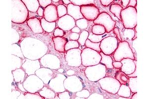 Anti-LRH-1 / NR5A2 antibody IHC of human adipocytes.