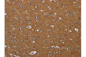 The image on the left is immunohistochemistry of paraffin-embedded Human brain tissue using ABIN7191878(PIK3CD Antibody) at dilution 1/20, on the right is treated with synthetic peptide. (PIK3CD 抗体)