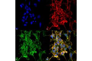 Immunocytochemistry/Immunofluorescence analysis using Mouse Anti-Citrulline Monoclonal Antibody, Clone 6C2. (Citrulline 抗体  (Atto 488))