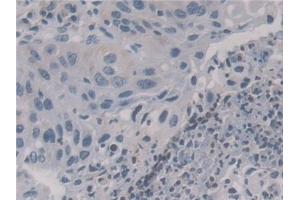 Immunohistochemistry (IHC) image for anti-Kinesin Family Member 18A (KIF18A) (AA 1-453) antibody (ABIN7436060)