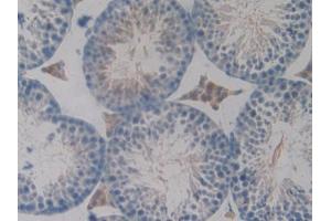 DAB staining on IHC-P; Samples: Mouse Testis Tissue (PKIG 抗体  (AA 1-76))