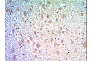 Immunohistochemical analysis of paraffin-embedded human brain tissues using KLHL21 mouse mAb with DAB staining. (KLHL21 抗体)