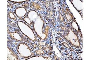 IHC analysis of CHM using anti-CHM antibody (ABIN6719537).