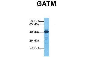 Western Blotting (WB) image for anti-Glycine Amidinotransferase (L-Arginine:glycine Amidinotransferase) (GATM) (Middle Region) antibody (ABIN2783416)