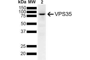 Western Blot analysis of Human SH-SY5Y lysates showing detection of 91. (VPS35 抗体  (Atto 594))