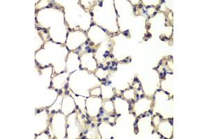 Immunohistochemistry of paraffin-embedded mouse lung using MAPK14 antibody (ABIN5998182) at dilution of 1/100 (40x lens). (MAPK14 抗体)