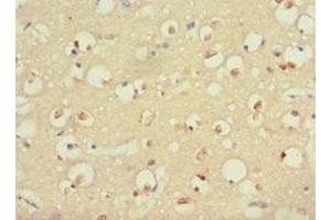 Immunohistochemistry of paraffin-embedded human brain tissue using ABIN7166082 at dilution of 1:100
