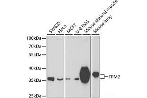 Western blot analysis of extracts of various cell lines using TPM2 Polyclonal Antibody at dilution of 1:400. (TPM2 抗体)