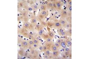Immunohistochemistry analysis in formalin fixed and paraffin embedded human liver tissue reacted with FBXO47 Antibody (N-term) followed by peroxidase conjugation of the secondary antibody and DAB staining. (FBXO47 抗体  (N-Term))