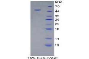 SDS-PAGE analysis of Human PSMC6 Protein. (PSMC6 蛋白)