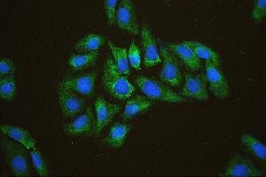 IF analysis of EIF4A using anti-EIF4A antibody (ABIN7601309).
