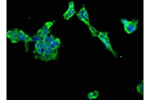 Immunofluorescence staining of 293 cells with ABIN7165907 at 1:66, counter-stained with DAPI. (Patched 2 抗体  (AA 793-951))