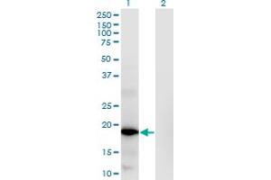 Western Blot analysis of RNASEH2C expression in transfected 293T cell line by RNASEH2C monoclonal antibody (M02), clone 5D6. (RNASEH2C 抗体  (AA 1-164))