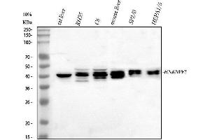 Western blot analysis of HnRNPF using anti-HnRNPF antibody (ABIN4886622).