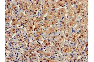Immunohistochemistry of paraffin-embedded human adrenal gland tissue using ABIN7153422 at dilution of 1:100 (GALT 抗体  (AA 1-379))