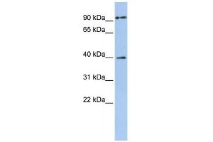 MAGEA6 antibody used at 1 ug/ml to detect target protein. (MAGEA6 抗体  (Middle Region))