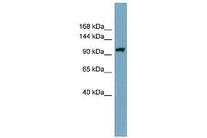 ELP2 antibody used at 1 ug/ml to detect target protein. (ELP2 抗体)