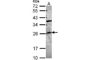 WB Image Sample (30 ug of whole cell lysate) A: A549 12% SDS PAGE antibody diluted at 1:1000 (GRAP 抗体  (C-Term))