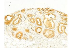 ABIN6260660 and ABIN6268685 at 1/100 staining Human normal tissues adjacent to breast cancer by IHC-P.