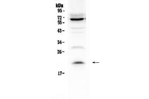 Western blot analysis of IL13 using anti-IL13 antibody . (IL-13 抗体  (AA 36-146))