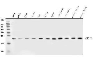 Western blot analysis of RAB7 using anti-RAB7 antibody (ABIN3044538). (RAB7A 抗体  (C-Term))