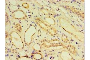 Immunohistochemistry of paraffin-embedded human kidney tissue using ABIN7148439 at dilution of 1:100 (CRX 抗体  (AA 120-285))