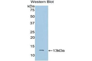 Western blot analysis of the recombinant protein. (CD59 抗体  (AA 26-98))