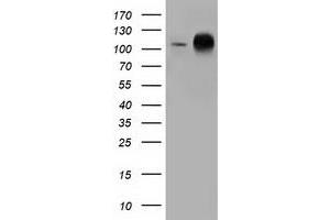 Western Blotting (WB) image for anti-Transforming, Acidic Coiled-Coil Containing Protein 3 (TACC3) antibody (ABIN1498100)