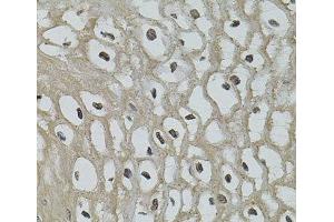 Immunohistochemistry of paraffin-embedded Human esophagus using IL33 Polyclonal Antibody (IL-33 抗体)
