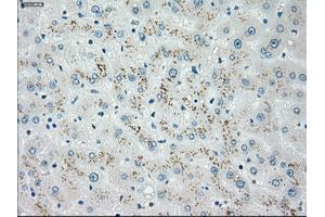 Immunohistochemical staining of paraffin-embedded Ovary tissue using anti-CHEK2mouse monoclonal antibody. (CHEK2 抗体)
