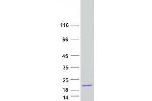 Western Blotting (WB) image for Eukaryotic Translation Initiation Factor 1B (EIF1B) protein (Myc-DYKDDDDK Tag) (ABIN2720048)